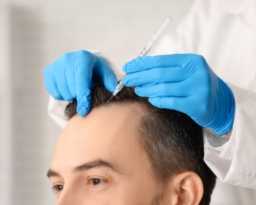 PRP for Hair Regrowth Mysore